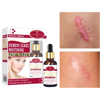 30ml Scar Remove Essence Anti Acne Cream Moisturizing Shrink Pores Anti-wrinkle Whitening Brighten Face Serum Skin Care
30ml Scar Remove Essence Anti Acne Cream Moisturizing Shrink Pores Anti-wrinkle Whitening Brighten Face Serum Skin Care
