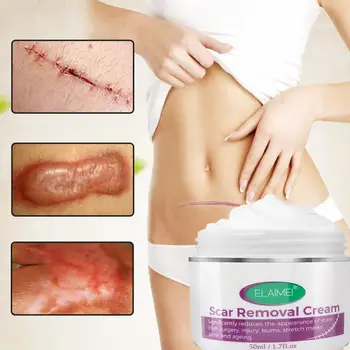ELAIMEI Scar Skin Body Cream Stretch Marks Remover Acne removal Powerful Postpartum Obesity Pregnancy Marks Face Creams 
ELAIMEI Scar Skin Body Cream Stretch Marks Remover Acne removal Powerful Postpartum Obesity Pregnancy Marks Face Creams