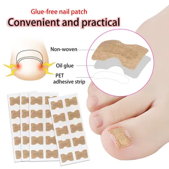 10 Stickers Ingrown Finger Toenail Correction Incorporated Orthodontic Toe Thumb Patch Sticker Straightening Pedicure Tools L302
10 Stickers Ingrown Finger Toenail Correction Incorporated Orthodontic Toe Thumb Patch Sticker Straightening Pedicure Tools L302