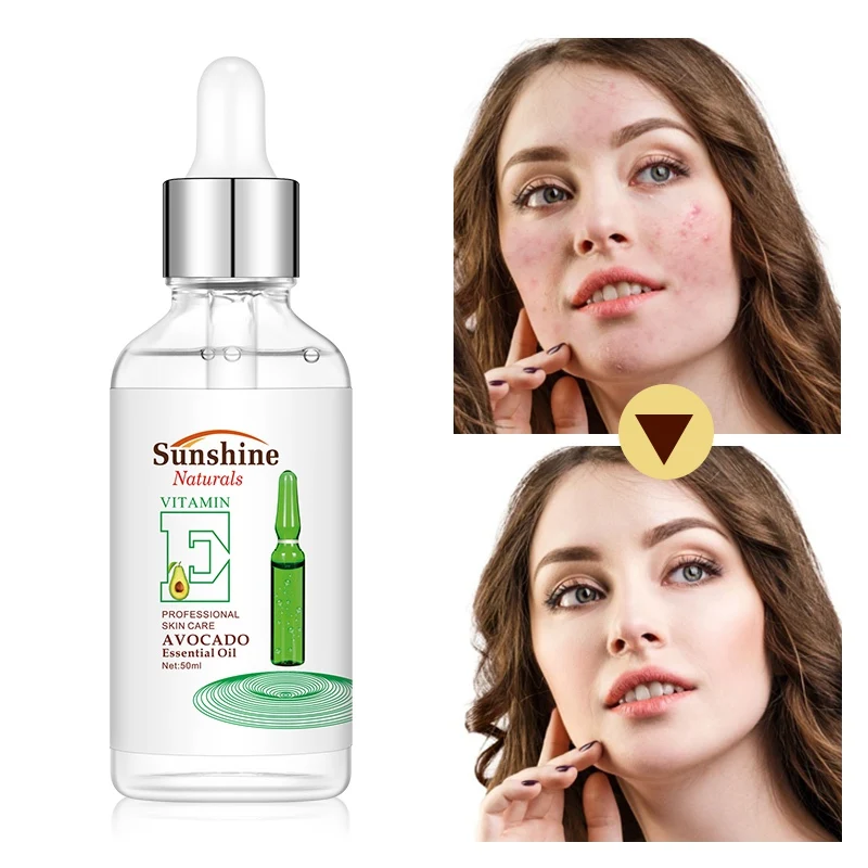 Avocado Essential Oils Essence Hydrating Shrinking Pores Firming Skin Brighten Skin Color Face Serum 1Pcs Face Care
Avocado Essential Oils Essence Hydrating Shrinking Pores Firming Skin Brighten Skin Color Face Serum 1Pcs Face Care