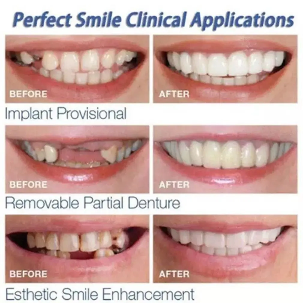 1 Set Silicone Teeth Whitening Teeth Cover Teeth Braces Simulation Upper Teeth Lower Teeth Set Perfect Smile
1 Set Silicone Teeth Whitening Teeth Cover Teeth Braces Simulation Upper Teeth Lower Teeth Set Perfect Smile
