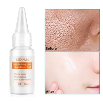 20ml Pore Refining Essence Tightens Refining Moisturizing Essence Whitening Anti-aging Soothing Invisible Pores Serum Liquid
20ml Pore Refining Essence Tightens Refining Moisturizing Essence Whitening Anti-aging Soothing Invisible Pores Serum Liquid