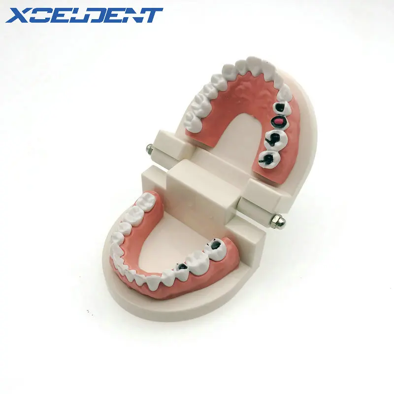 1pcs Dental Caries Tooth Study & Teaching Model Typodont Demonstration Adult Size Dentistry Instrument
1pcs Dental Caries Tooth Study & Teaching Model Typodont Demonstration Adult Size Dentistry Instrument