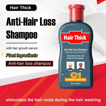 200ml C1 Anti-hair Loss Shampoo with Hair Growth Serum Hair Loss Products for Men
200ml C1 Anti-hair Loss Shampoo with Hair Growth Serum Hair Loss Products for Men