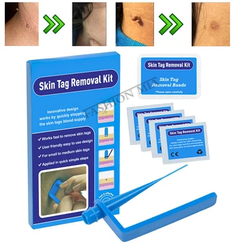 Portable Home Use Micro Mole Wart Remover Skin Tag Removal Kit With Cleansing Swab Adult Mole Wart Face Care Tool Safe Efficient
Portable Home Use Micro Mole Wart Remover Skin Tag Removal Kit With Cleansing Swab Adult Mole Wart Face Care Tool Safe Efficient