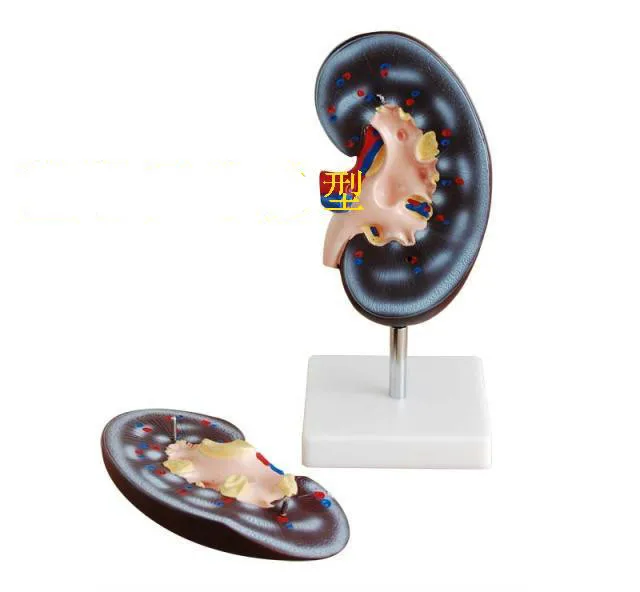 2X Enlarged Renal Anatomy Model The Anatomical of Human Kidney Amplification Medical Teaching Supplies | Канцтовары для офиса и