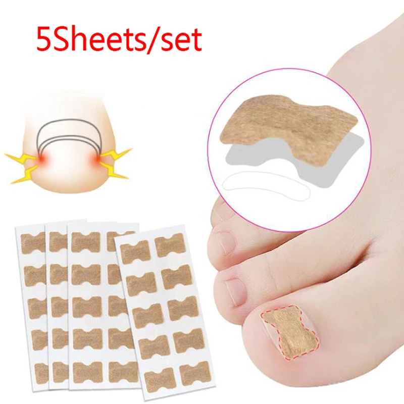 Ingrown Toenail Corrector Stickers Paronychia Treatment Recover Corrector Pedicure Tools Fingernail Toe Nail Care 5pcs/Pack
Ingrown Toenail Corrector Stickers Paronychia Treatment Recover Corrector Pedicure Tools Fingernail Toe Nail Care 5pcs/Pack