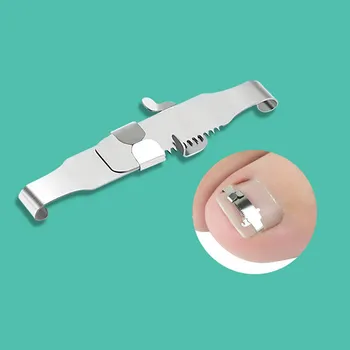Stainless Steel Ingrown Toe Nail Fixer Corrector Pedicure Recover Embed Toenail Correction Lifter Tool Kit
Stainless Steel Ingrown Toe Nail Fixer Corrector Pedicure Recover Embed Toenail Correction Lifter Tool Kit