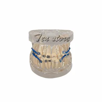 Orthodontic teeth model, metal braces wrong teeth jaws demonstration model, orthodontic teeth training model
Orthodontic teeth model, metal braces wrong teeth jaws demonstration model, orthodontic teeth training model