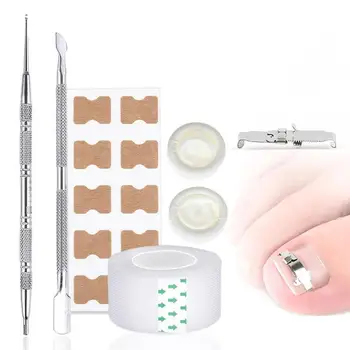 Orthognathic Buckle Nail Groove Correction Device Tension Ingrown Nail Ingrown Nail, Long Fleshy Toenail Patch Pedicure Orthodon
Orthognathic Buckle Nail Groove Correction Device Tension Ingrown Nail Ingrown Nail, Long Fleshy Toenail Patch Pedicure Orthodon