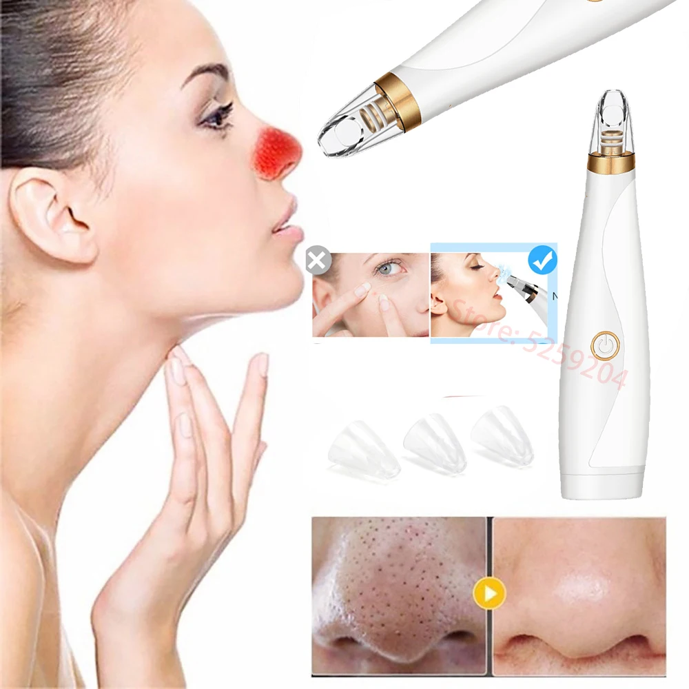 Beauty Electric Suction Facial BlackHead Pore Cleaning Machine Device for Extractor Nose Facial Cleaner blackhead removal Vacuum
Beauty Electric Suction Facial BlackHead Pore Cleaning Machine Device for Extractor Nose Facial Cleaner blackhead removal Vacuum