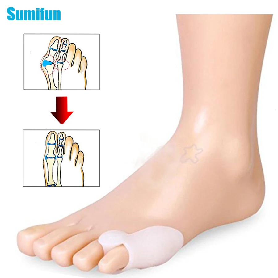 

4Pcs Hallux Valgus Orthotics Toe Separator Corrector Straightener Insoles Toe Foot Massager Little Toe Feet Care Pedicure D2320