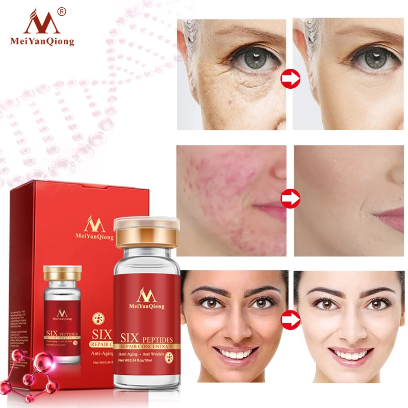 MeiYanQiong Six Peptides Face Serum Anti-aging Anti Wrinkle Face Cream Improve Fine Lines Moisturizing Acne Removal Skin Repair
MeiYanQiong Six Peptides Face Serum Anti-aging Anti Wrinkle Face Cream Improve Fine Lines Moisturizing Acne Removal Skin Repair