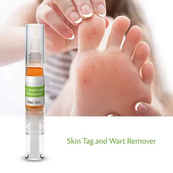 Hot Corn Remover Callus Remover Callus Eliminator Callus And Corn Remover Liquid 3ml t6
Hot Corn Remover Callus Remover Callus Eliminator Callus And Corn Remover Liquid 3ml t6