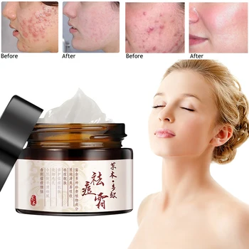 30ml Skin Care Acne Cream Anti Acne Treatment Pimple Removal Anti-Inflammation Pores Scar Whitening Salicylic Acid Gel TSLM1 
30ml Skin Care Acne Cream Anti Acne Treatment Pimple Removal Anti-Inflammation Pores Scar Whitening Salicylic Acid Gel TSLM1