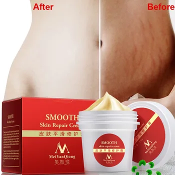Body Cream Natural Essence Repair Cream For Stretch Marks Scar Removal Skin Repair Postpartum Care
Body Cream Natural Essence Repair Cream For Stretch Marks Scar Removal Skin Repair Postpartum Care