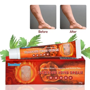 Varicose Veins Treatment Cream Ointment Vasculitis Phlebitis Spider Veins Pain Varicosity Angiitis Remedy Removal Herbal Cream 
Varicose Veins Treatment Cream Ointment Vasculitis Phlebitis Spider Veins Pain Varicosity Angiitis Remedy Removal Herbal Cream