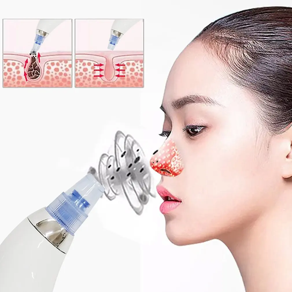 Blackhead Remover Face Deep Pore Cleaner Acne Pimple Removal Vacuum Suction Facial SPA Diamond Beauty Care Tool Skin Care
Blackhead Remover Face Deep Pore Cleaner Acne Pimple Removal Vacuum Suction Facial SPA Diamond Beauty Care Tool Skin Care