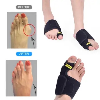 Economic Velvet Black Getting Fix Fast Foot Tool Care Corrector Thumb Toe Orthotics Hallux Valgus Health Legs Strap Comfortable
Economic Velvet Black Getting Fix Fast Foot Tool Care Corrector Thumb Toe Orthotics Hallux Valgus Health Legs Strap Comfortable
