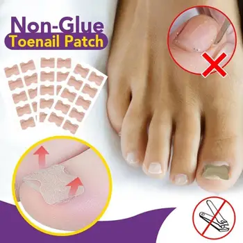 Non-Glue Toenail Patch Non-Glue Toenail Patch Nail Correction Patch Correction Nail Correction Patch
Non-Glue Toenail Patch Non-Glue Toenail Patch Nail Correction Patch Correction Nail Correction Patch