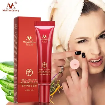 Face Acne Cleaning Cream Skin Care Remove Repair Comedone Pimple Acne Quickly Face Acne Cream Remover Anti Acne Treatment
Face Acne Cleaning Cream Skin Care Remove Repair Comedone Pimple Acne Quickly Face Acne Cream Remover Anti Acne Treatment