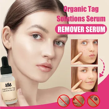 Organic Tags Solutions Serum Herbal Treatment Serum Remove Unwanted Skin Flaws 20ML AAll Natural Tags Free Serum Dropshipping #
Organic Tags Solutions Serum Herbal Treatment Serum Remove Unwanted Skin Flaws 20ML AAll Natural Tags Free Serum Dropshipping #