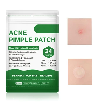 MO TULIP Invisible Acne Removal Pimple Patch can absorb Acne Secretions Effectively Acne Patches Fast Healing Suitable For Night
MO TULIP Invisible Acne Removal Pimple Patch can absorb Acne Secretions Effectively Acne Patches Fast Healing Suitable For Night