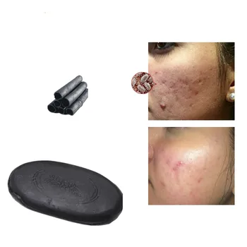 Honey moisture and nourishing soap removal acne cleaning cream soap softening keratinocyte Soap can prevent acne blackhead soap
Honey moisture and nourishing soap removal acne cleaning cream soap softening keratinocyte Soap can prevent acne blackhead soap