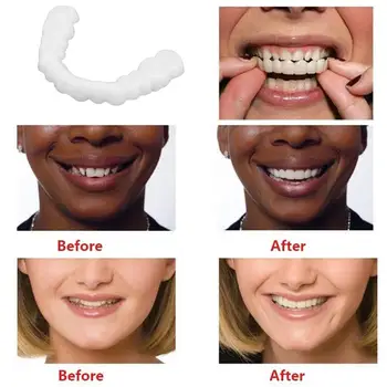 HOT Tooth Instant Perfect Smile Flex Teeth Whitening Smile False Teeth Cover Tool
HOT Tooth Instant Perfect Smile Flex Teeth Whitening Smile False Teeth Cover Tool