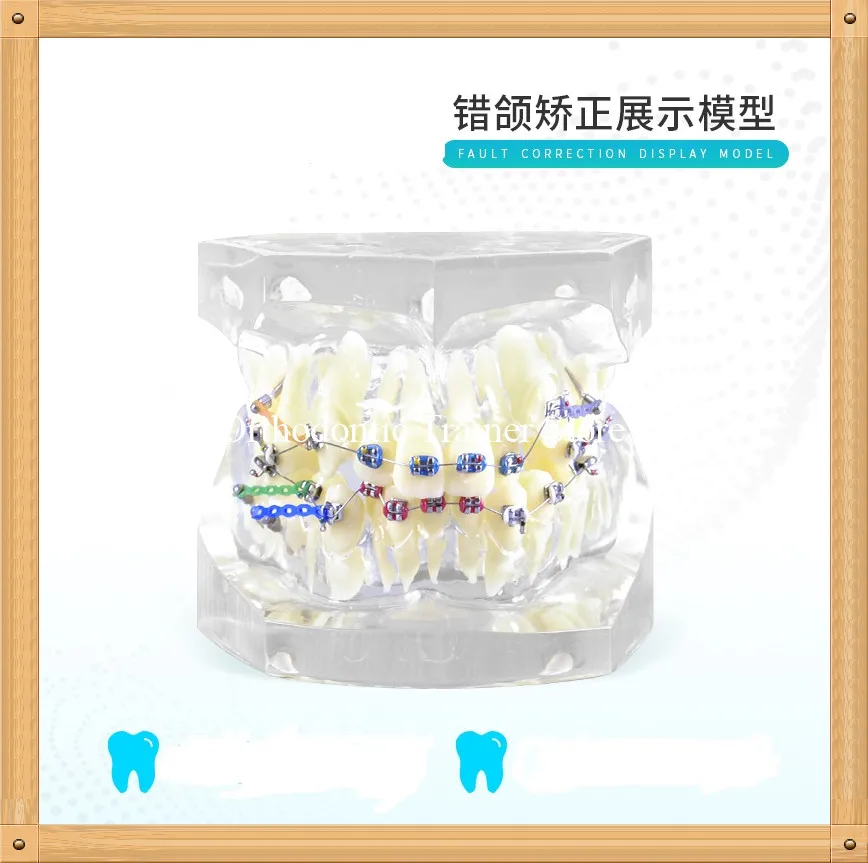 Orthodontic teeth model with bracket and ligature wire dispaly Fault Correction/Dental Orthodontic Model
Orthodontic teeth model with bracket and ligature wire dispaly Fault Correction/Dental Orthodontic Model