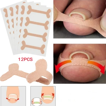 12pcs Professional Embedded Toe Nail Corrector Sticker Toenail Care Pedicure Thumb Curl Correction Sticker Bandage Toe Nail Care
12pcs Professional Embedded Toe Nail Corrector Sticker Toenail Care Pedicure Thumb Curl Correction Sticker Bandage Toe Nail Care