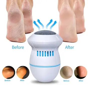 Foot Care Tool Callus USB Rechargeable Foot File Electric Vacuum Automatic Adsorption Foot Grinder for Dead Skin Removal
Foot Care Tool Callus USB Rechargeable Foot File Electric Vacuum Automatic Adsorption Foot Grinder for Dead Skin Removal