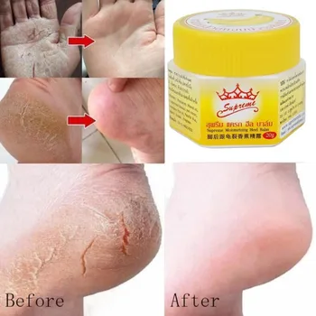 Foot Crack Cream Heel Chapped Peeling Repair Anti Dry Crack Remove Dead Skin Soften Feet Care Banana Oil Foot Cream Repair ZJXM1
Foot Crack Cream Heel Chapped Peeling Repair Anti Dry Crack Remove Dead Skin Soften Feet Care Banana Oil Foot Cream Repair ZJXM1