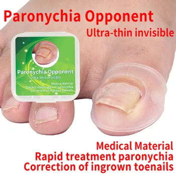 2PCS Toenail Protector for Ingrown Toenail Correction Tools Big Toe Sleeves Toe Cap Ingrown Nail Corn Cushion Cap Toe Separators
2PCS Toenail Protector for Ingrown Toenail Correction Tools Big Toe Sleeves Toe Cap Ingrown Nail Corn Cushion Cap Toe Separators