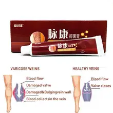 1pc Varicose Veins Treatment Cream Relief Veins Pain Phlebitis Legs Varicosity Angiitis Remedy Ointment Health Care
1pc Varicose Veins Treatment Cream Relief Veins Pain Phlebitis Legs Varicosity Angiitis Remedy Ointment Health Care