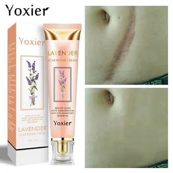 Lavender Scar Repair Cream Repairing Removing Burn Scars Promote Cell Regeneration Enhance Elasticity Cucumber Skin Care 20g
Lavender Scar Repair Cream Repairing Removing Burn Scars Promote Cell Regeneration Enhance Elasticity Cucumber Skin Care 20g