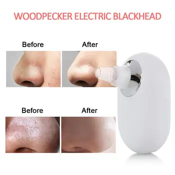 Cosmetic Instrument Black Head Cleaner Blackhead Removal Equipment 2 Colors ABS Effective Fast Fashion Beauty Health Remove
Cosmetic Instrument Black Head Cleaner Blackhead Removal Equipment 2 Colors ABS Effective Fast Fashion Beauty Health Remove