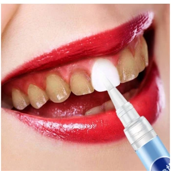 3 Pcs Toothpaste Stain Remover Pen Clean New Tooth Bleaching Teeth Whitener Gel Pen Absolute White Tooth Whitener Delicate 
3 Pcs Toothpaste Stain Remover Pen Clean New Tooth Bleaching Teeth Whitener Gel Pen Absolute White Tooth Whitener Delicate