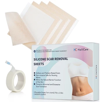 Professional Silicone Scar Sheets Removal Patch Acne Gel Scar Strips Therapy Silicon Pads Remove Trauma Burn Sheet Skin Repair 
Professional Silicone Scar Sheets Removal Patch Acne Gel Scar Strips Therapy Silicon Pads Remove Trauma Burn Sheet Skin Repair