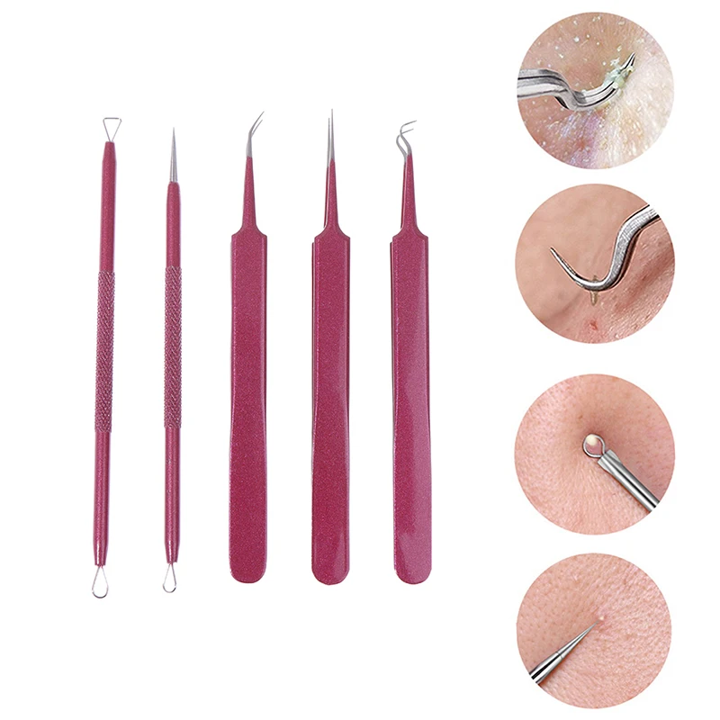 1PCS Tools Acne Extractor Remover Blackhead Pimple Needles Blemish Treatments 6 Types
1PCS Tools Acne Extractor Remover Blackhead Pimple Needles Blemish Treatments 6 Types