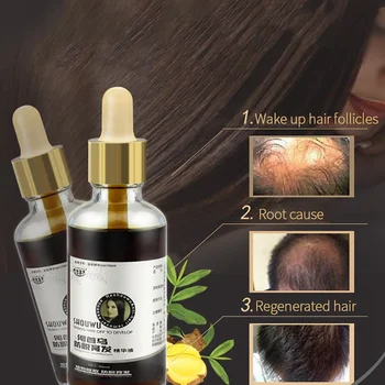 Plant Extract Anti-off Hair Care Dense Regrowth Ginger Serum Oil Anti Loss Treatment Essence Fast Hair Growth Oil
Plant Extract Anti-off Hair Care Dense Regrowth Ginger Serum Oil Anti Loss Treatment Essence Fast Hair Growth Oil