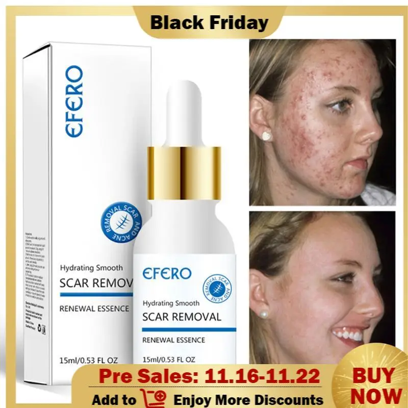 Efero Scar Remove Essence Acne Treatment Blackhead Removal Anti Acne Cream Oil Control Shrink Pores Acne Face Care Whitening TSL
Efero Scar Remove Essence Acne Treatment Blackhead Removal Anti Acne Cream Oil Control Shrink Pores Acne Face Care Whitening TSL