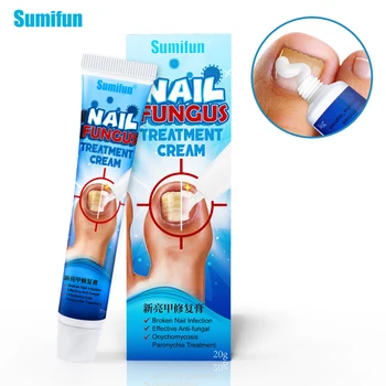 Sumifun 1pcs Nail Repair Cream Nail Fungus Treatment Onychomycosis Paronychia Ointment Dead Skin Removal Nail Growth CreamK10010
Sumifun 1pcs Nail Repair Cream Nail Fungus Treatment Onychomycosis Paronychia Ointment Dead Skin Removal Nail Growth CreamK10010
