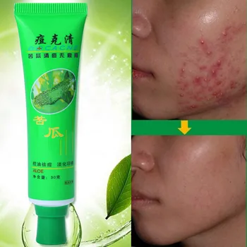 30gface Skin Care Acne Cream Oil Control Acne Products Face Cream Beauty Face Moisturizing Cream Remove Acne Aloe Vera Skin Care
30gface Skin Care Acne Cream Oil Control Acne Products Face Cream Beauty Face Moisturizing Cream Remove Acne Aloe Vera Skin Care
