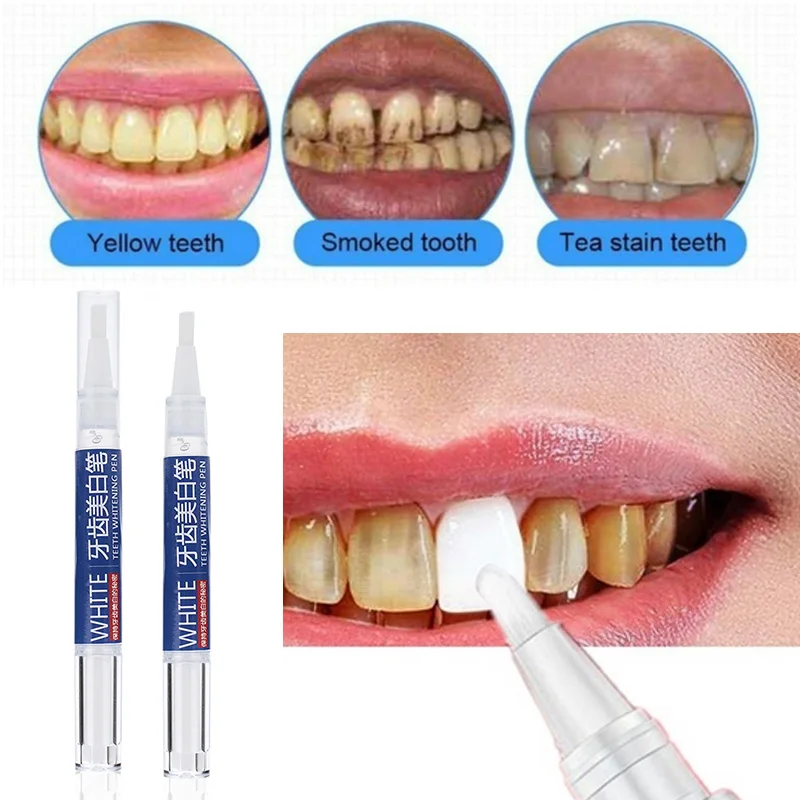 Clean Dental Cleaning Dentifrice Toothpaste Liquid 3.0ml Tooth Whitening Pen Fashion Bright White Care
Clean Dental Cleaning Dentifrice Toothpaste Liquid 3.0ml Tooth Whitening Pen Fashion Bright White Care