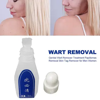 6ml Genital Wart Treatment Papillomas Removal Of Warts From Skin Tags Removing Against Moles Remover Anti Verruca Remedy 
6ml Genital Wart Treatment Papillomas Removal Of Warts From Skin Tags Removing Against Moles Remover Anti Verruca Remedy