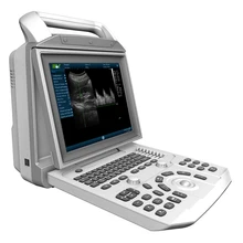 Black & white Animal Diagnostic Apparatuses Pets Clinical Ultrasound Scanner Veterinary Ultrasound Device
Black & white Animal Diagnostic Apparatuses Pets Clinical Ultrasound Scanner Veterinary Ultrasound Device