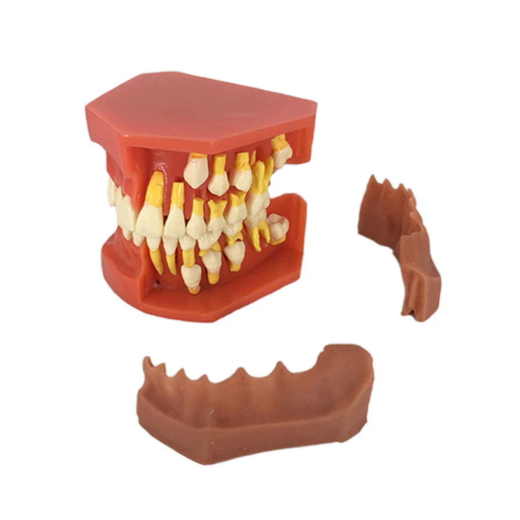 Drop Ship Dental Children Removable Deciduous Teeth Model Permanent Tooth Alternative Display Studying Teaching Tool
Drop Ship Dental Children Removable Deciduous Teeth Model Permanent Tooth Alternative Display Studying Teaching Tool