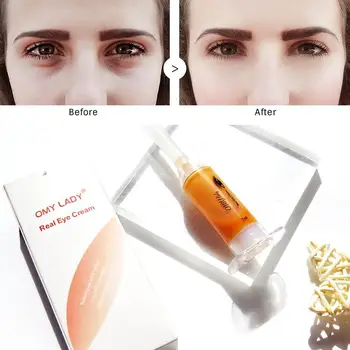 OMY LADY EyeCream Instant Remove Eyebags Firming Eye Eye Circles Wrinkle Puffiness Anti Under Eye Care Age Dark Anti Anti C7K6
OMY LADY EyeCream Instant Remove Eyebags Firming Eye Eye Circles Wrinkle Puffiness Anti Under Eye Care Age Dark Anti Anti C7K6