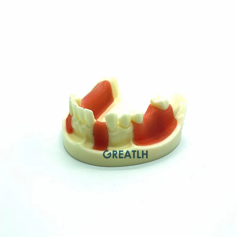 Фото Стоматологическая нижняя челюсть Gingiva модель отсутствующие зубы | Стоматологическая учебная модель (1005001304259777)